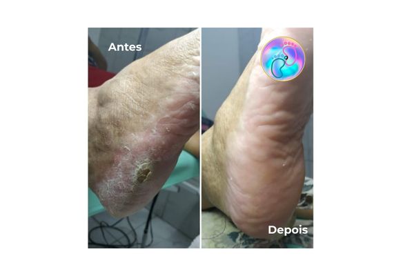 Foto de antes e depois do tratamento 6